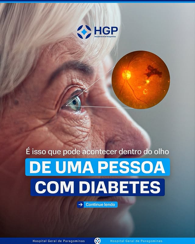 Publicação do HGP sobre prevenção e saúde dos olhos